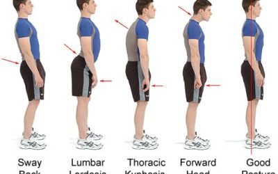 Three Signs That You Have Muscle Imbalance In Your Body