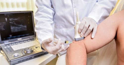 Ultrasound-guided platelet-rich plasma injection of the elbow in West Palm Beach Florida