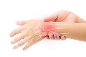Leading experts in West palm beach Florida for Tennis Elbow using PRP Therapy